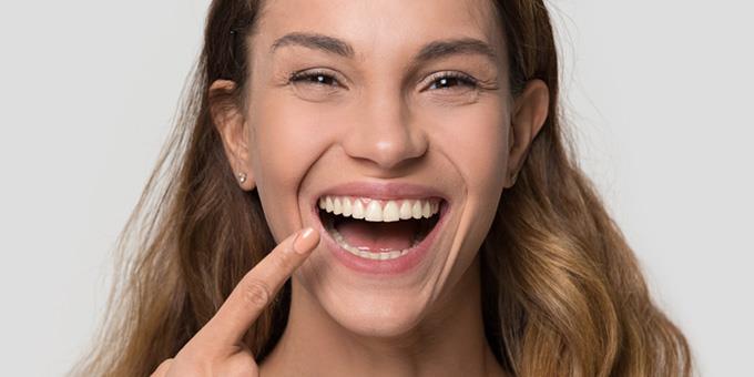 Πώς το Invisalign ισιώνει τα δόντια